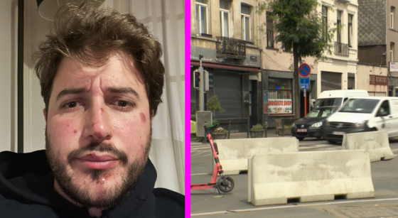un député bruxellois se blesse en heurtant un bloc de beton - photo : twitter
